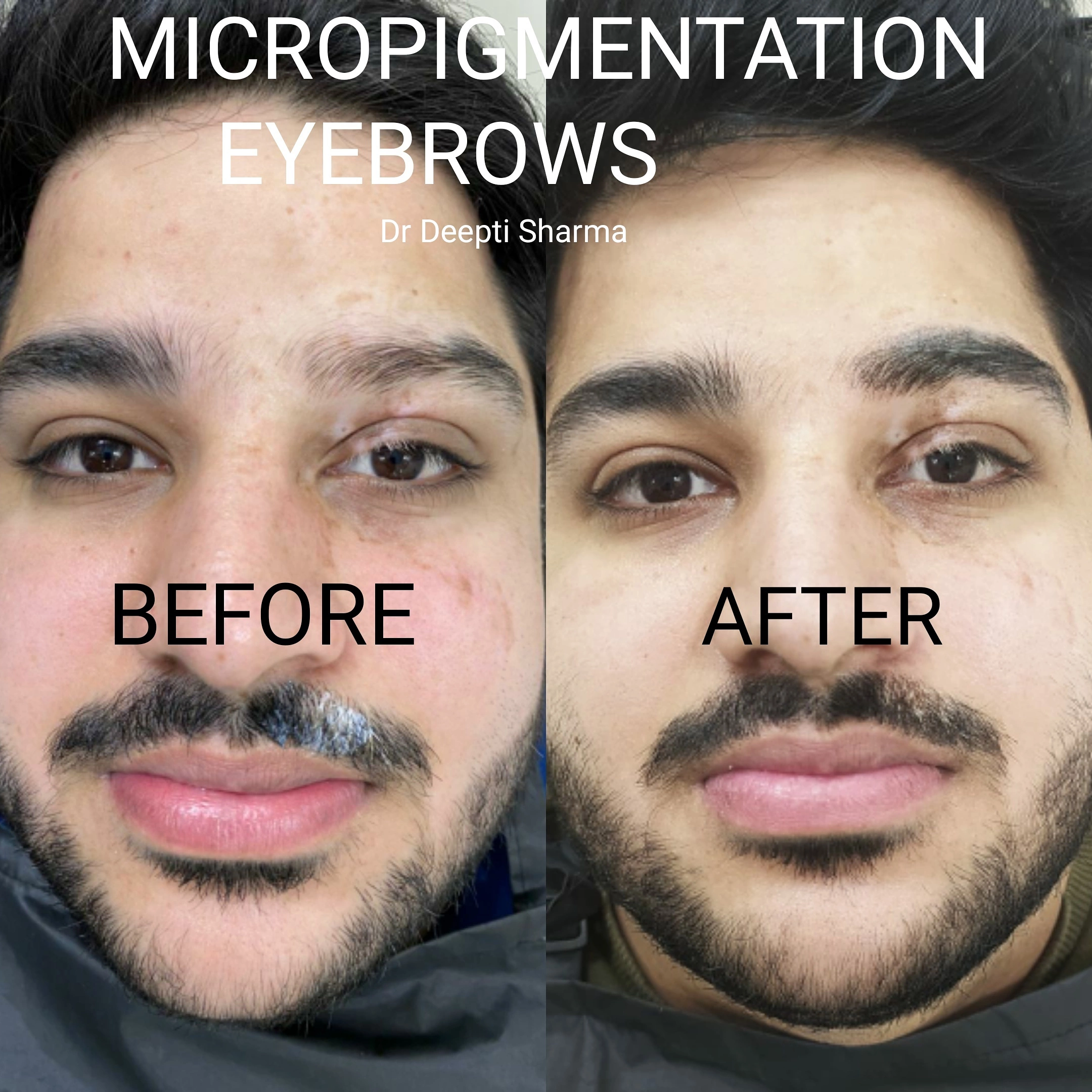 Patient Image
