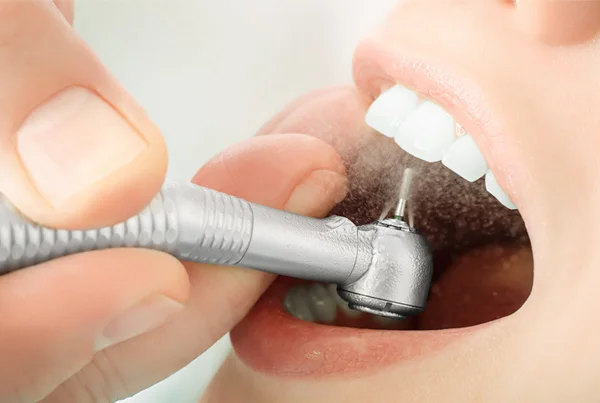 Restorative Dentistry (Filling)