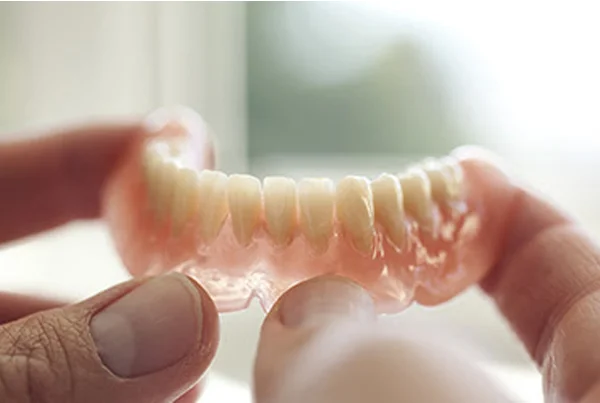 Prosthodontic Treatments (Complete Dentures ,Fixed and removable prosthesis)