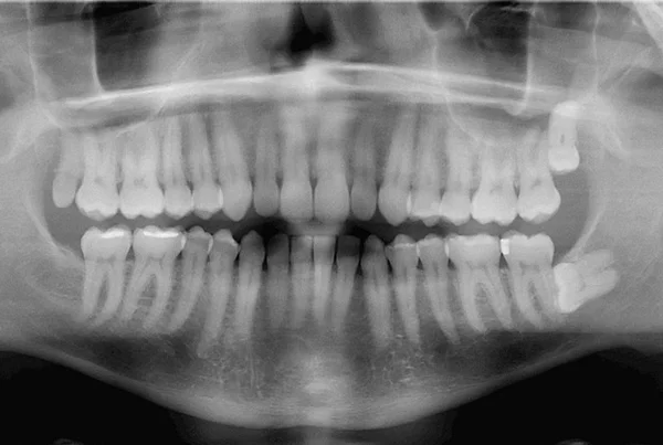 Dental Imaging