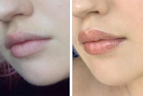 Lip Blush