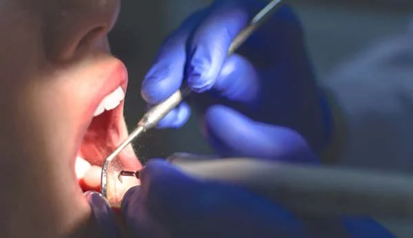 Advanced Dentistry